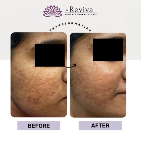 Before and after result 7